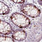 MIC-1 antibody, AMAb90687, Atlas Antibodies, Immunohistochemistry paraffin image 