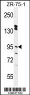 Endoplasmic Reticulum Metallopeptidase 1 antibody, 55-422, ProSci, Western Blot image 