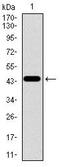 Transforming Growth Factor Beta Receptor 3 antibody, MA5-17187, Invitrogen Antibodies, Western Blot image 