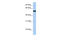 Transcription Factor AP-2 Gamma antibody, 25-141, ProSci, Enzyme Linked Immunosorbent Assay image 