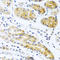 Prokineticin 2 antibody, A03494, Boster Biological Technology, Immunohistochemistry paraffin image 