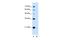 DCTP Pyrophosphatase 1 antibody, A11334, Boster Biological Technology, Western Blot image 