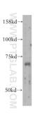 Interleukin 22 Receptor Subunit Alpha 1 antibody, 13462-1-AP, Proteintech Group, Western Blot image 