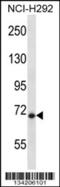 HIC ZBTB Transcriptional Repressor 1 antibody, 57-498, ProSci, Western Blot image 