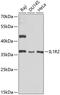 Interleukin 1 Receptor Type 2 antibody, 18-370, ProSci, Western Blot image 