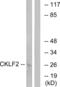 CKLF Like MARVEL Transmembrane Domain Containing 2 antibody, abx014366, Abbexa, Western Blot image 