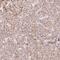 Solute Carrier Family 17 Member 4 antibody, NBP2-57090, Novus Biologicals, Immunohistochemistry paraffin image 