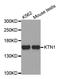 Kinectin 1 antibody, orb373295, Biorbyt, Western Blot image 