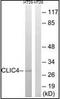 Chloride Intracellular Channel 4 antibody, orb96056, Biorbyt, Western Blot image 