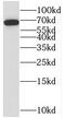 Signal Transducing Adaptor Molecule 2 antibody, FNab08284, FineTest, Western Blot image 