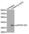 Eukaryotic Translation Initiation Factor 2 Subunit Alpha antibody, MBS128542, MyBioSource, Western Blot image 