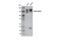 ATP Binding Cassette Subfamily B Member 1 antibody, 13978S, Cell Signaling Technology, Western Blot image 