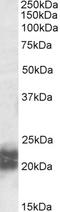 NPC Intracellular Cholesterol Transporter 2 antibody, EB09947, Everest Biotech, Western Blot image 