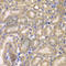 Caspase Recruitment Domain Family Member 10 antibody, A7368, ABclonal Technology, Immunohistochemistry paraffin image 