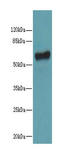 Keratin 73 antibody, A65934-100, Epigentek, Western Blot image 
