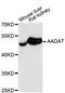 Aminoadipate Aminotransferase antibody, A09111, Boster Biological Technology, Western Blot image 