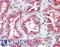 Solute Carrier Family 22 Member 1 antibody, LS-B15175, Lifespan Biosciences, Immunohistochemistry paraffin image 