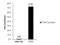 ETS Proto-Oncogene 2, Transcription Factor antibody, PA5-28053, Invitrogen Antibodies, Chromatin Immunoprecipitation image 