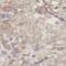 AKT1 Substrate 1 antibody, FNab09942, FineTest, Immunohistochemistry paraffin image 