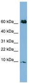 Cysteine-rich protein 1 antibody, TA339220, Origene, Western Blot image 