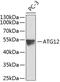 Autophagy Related 12 antibody, 23-385, ProSci, Western Blot image 