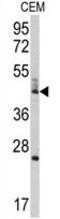 BCL2 Like 13 antibody, GTX81253, GeneTex, Western Blot image 