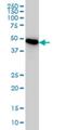 Proteasome 26S Subunit, ATPase 3 antibody, H00005702-M01, Novus Biologicals, Western Blot image 