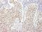 Factor Interacting With PAPOLA And CPSF1 antibody, NB100-74588, Novus Biologicals, Immunohistochemistry paraffin image 