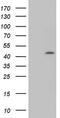 Cyclin D1 antibody, CF804673, Origene, Western Blot image 