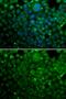 Crystallin Alpha A antibody, GTX65843, GeneTex, Immunocytochemistry image 