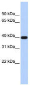 Phospholipid Phosphatase Related 5 antibody, TA336129, Origene, Western Blot image 
