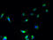 Estradiol 17-beta-dehydrogenase 12 antibody, A59426-100, Epigentek, Immunofluorescence image 
