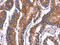 Carnitine O-Octanoyltransferase antibody, CSB-PA967648, Cusabio, Immunohistochemistry paraffin image 