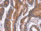 Peroxisomal carnitine O-octanoyltransferase antibody, CSB-PA967648, Cusabio, Immunohistochemistry paraffin image 