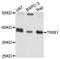 Tribbles homolog 1 antibody, orb373062, Biorbyt, Western Blot image 