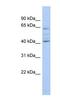 Zinc Finger Protein 674 antibody, NBP1-91371, Novus Biologicals, Western Blot image 