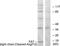 Coagulation Factor VII antibody, LS-C121076, Lifespan Biosciences, Western Blot image 