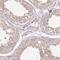 RB1 Inducible Coiled-Coil 1 antibody, HPA024391, Atlas Antibodies, Immunohistochemistry frozen image 
