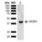 Receptor Tyrosine Kinase Like Orphan Receptor 1 antibody, LS-C774738, Lifespan Biosciences, Western Blot image 