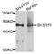 Adenylate Cyclase 2 antibody, STJ111847, St John