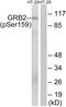 Growth Factor Receptor Bound Protein 2 antibody, PA5-37587, Invitrogen Antibodies, Western Blot image 