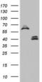 Dolichyl-Diphosphooligosaccharide--Protein Glycosyltransferase Non-Catalytic Subunit antibody, LS-C789959, Lifespan Biosciences, Western Blot image 