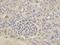 Sca3 antibody, orb49146, Biorbyt, Immunohistochemistry paraffin image 