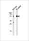 Tubulin Alpha 1c antibody, MBS9208226, MyBioSource, Western Blot image 