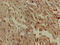 N-Acylsphingosine Amidohydrolase 1 antibody, LS-C677201, Lifespan Biosciences, Immunohistochemistry paraffin image 