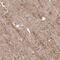 TraB Domain Containing antibody, HPA000822, Atlas Antibodies, Immunohistochemistry frozen image 