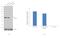 FYN Proto-Oncogene, Src Family Tyrosine Kinase antibody, MA1-19331, Invitrogen Antibodies, Western Blot image 