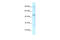 Gamma-Aminobutyric Acid Type A Receptor Pi Subunit antibody, 31-107, ProSci, Western Blot image 