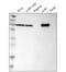 Citrin antibody, HPA018997, Atlas Antibodies, Western Blot image 