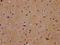 Mex-3 RNA Binding Family Member B antibody, LS-C680854, Lifespan Biosciences, Immunohistochemistry paraffin image 